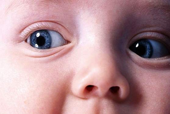 Младенец с серо-голубыми глазами