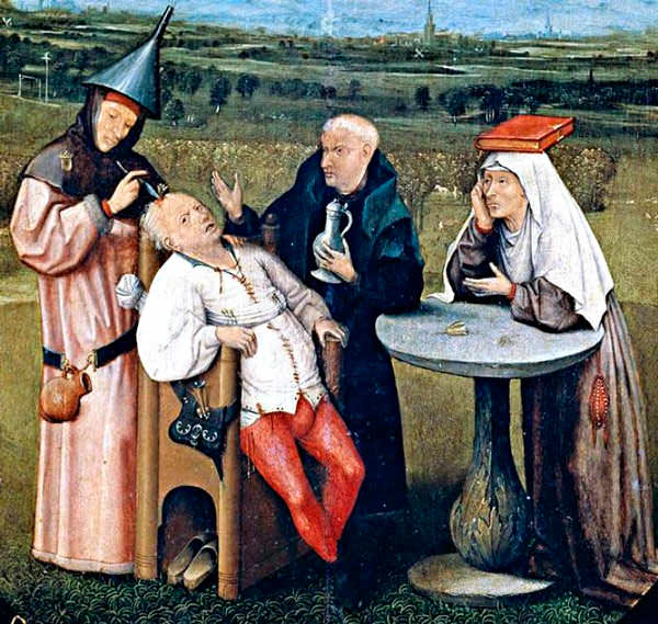 Трепанация в средневековье 
