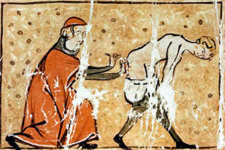 Лечение геморроя при помощи раскаленного железа в средневековье 