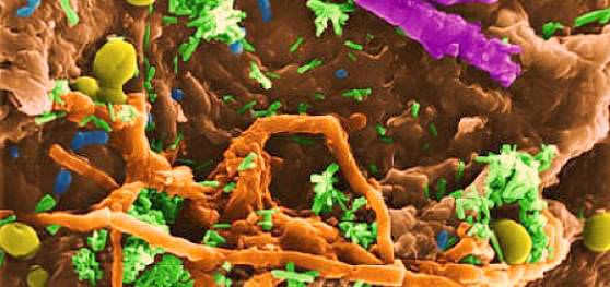 Микробы в человеческом организме 