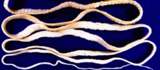 Плоские черви которые живут в человеческом организме 